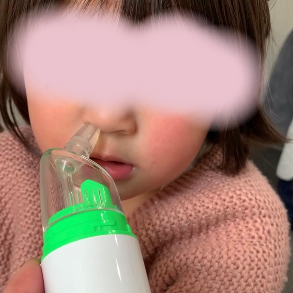 ２歳幼児の鼻にシリコンノズルを入れて大きさを確認した写真。